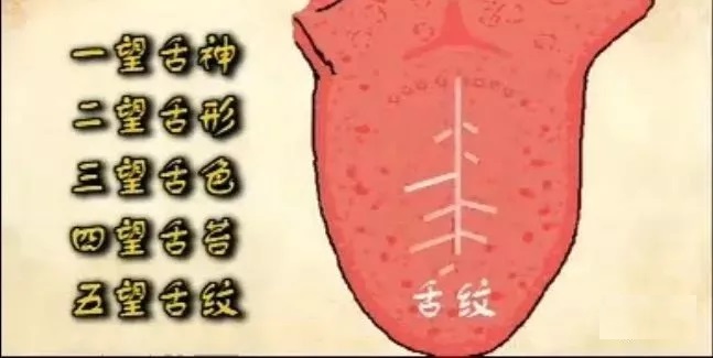 中医舌诊,很实用